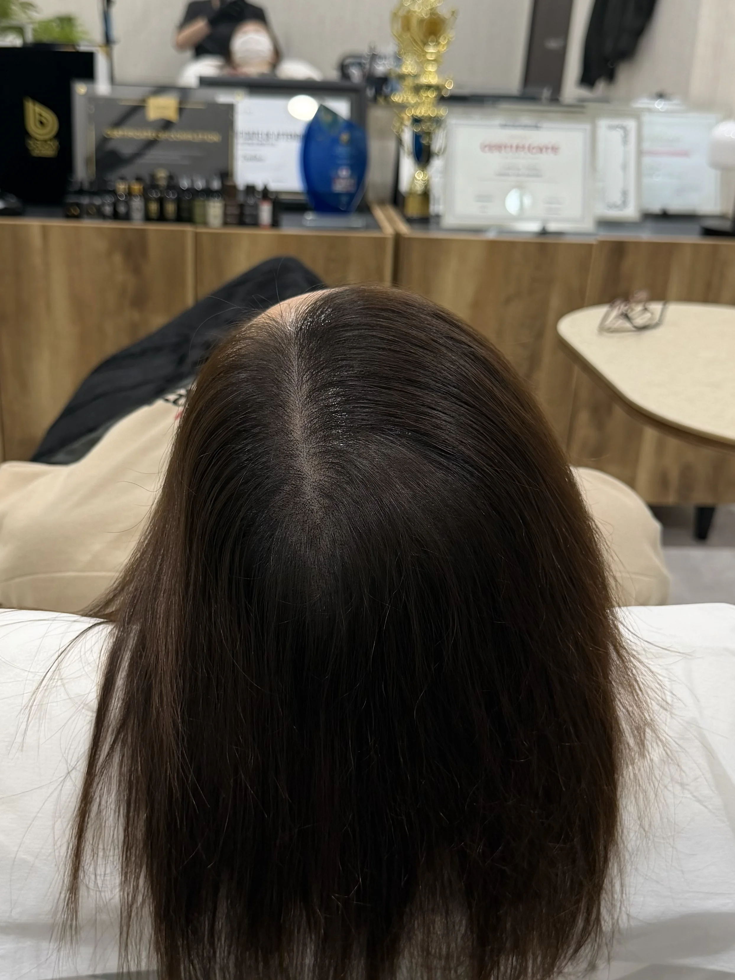分け目 施術後