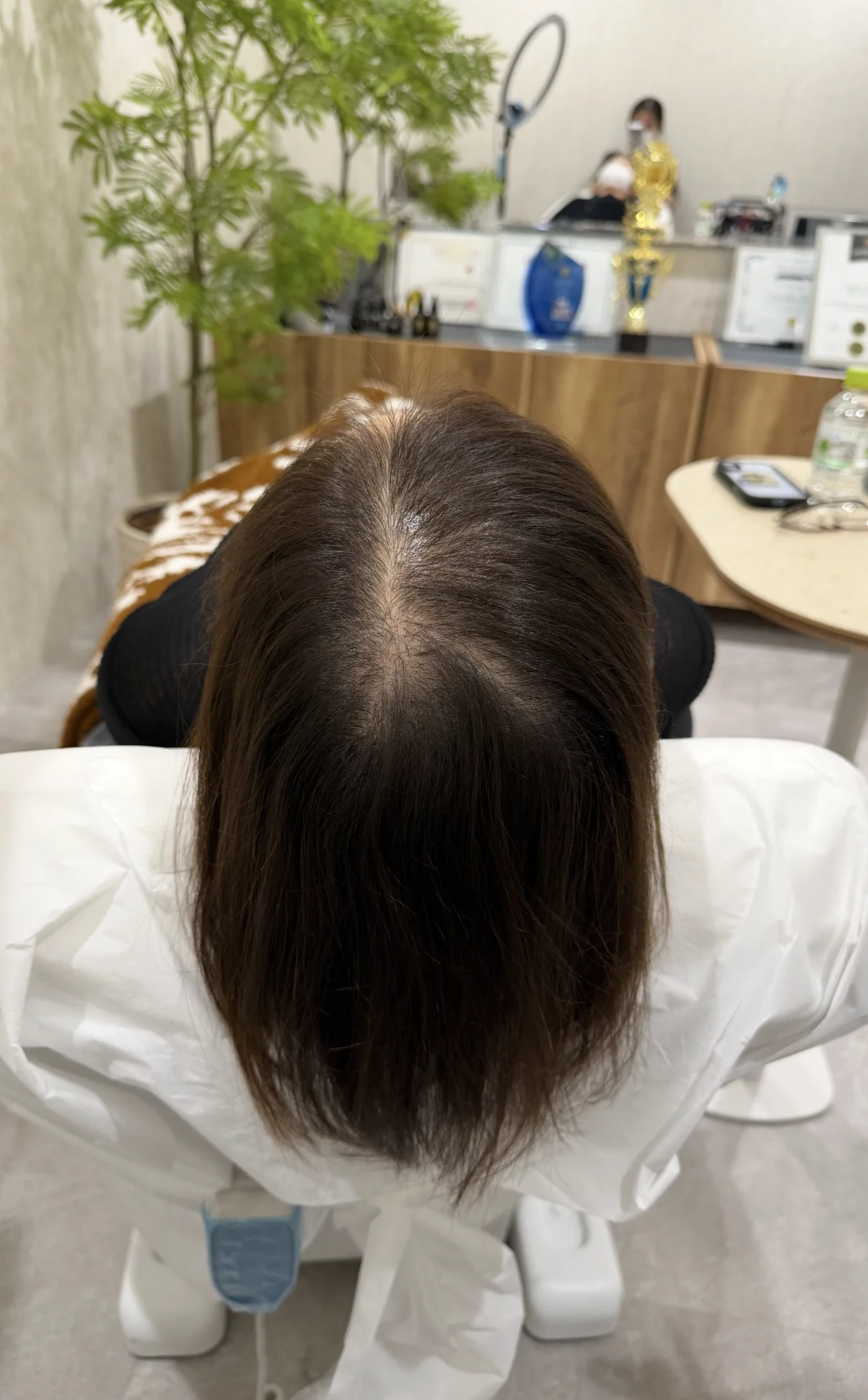 分け目 施術前