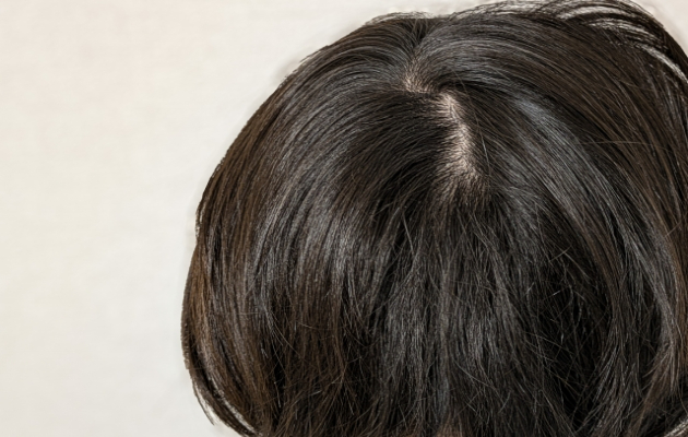 頭皮アートメイクで頭頂部をカバーする