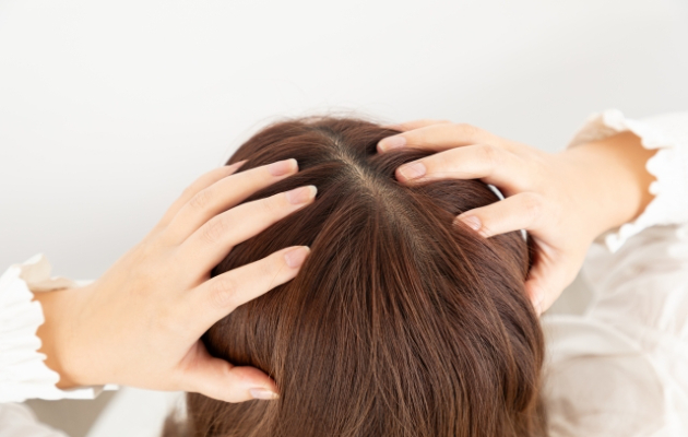 頭皮の状態に悩む女性